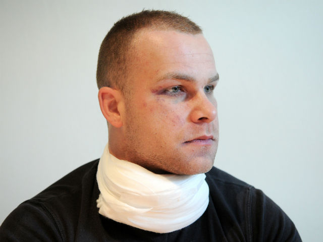 Тренерот по фитнес Горан Мишиќ, закрепнува откако бил претепан во ноќен клуб во Бања Лука | Фото: Независне новине, Бања Лука