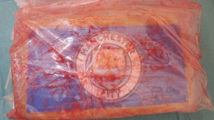 Фотографија од пакет со кокаин со лого на Манчестер сити