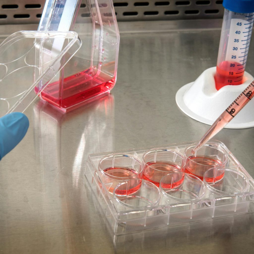 Споделете искуства за чување матични клетки